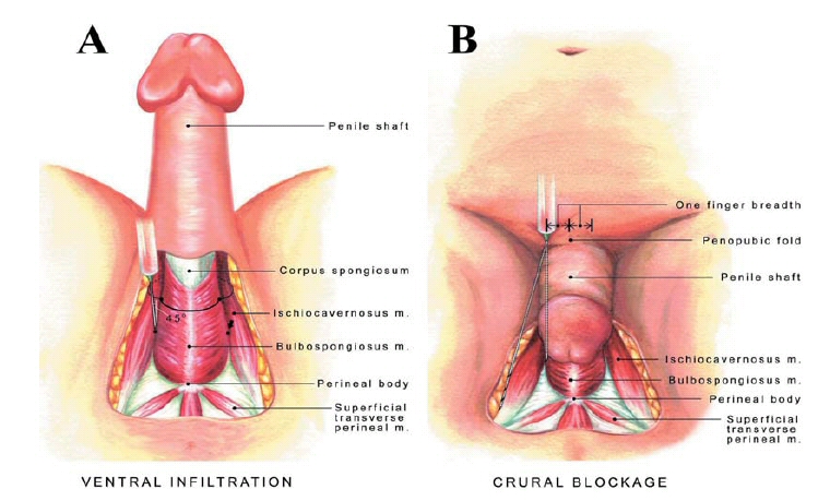 Penis Tendon 44